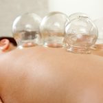 hijama